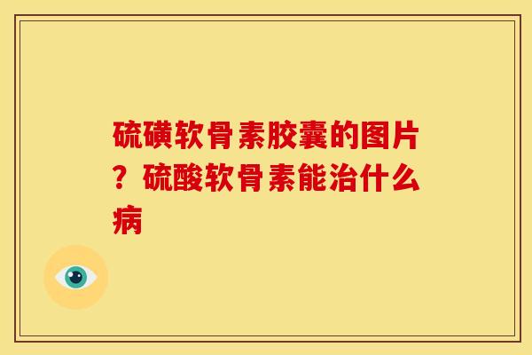 硫磺软骨素胶囊的图片？硫酸软骨素能治什么病