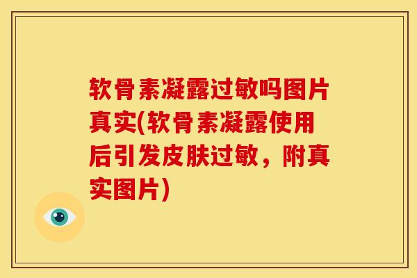 软骨素凝露过敏吗图片真实(软骨素凝露使用后引发皮肤过敏，附真实图片)