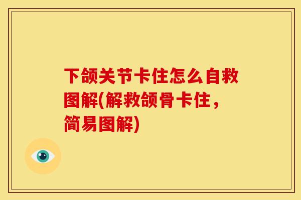 下颌关节卡住怎么自救图解(解救颌骨卡住，简易图解)