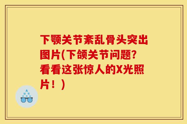 下颚关节紊乱骨头突出图片(下颌关节问题？看看这张惊人的X光照片！)