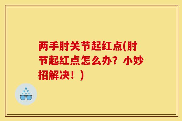 两手肘关节起红点(肘节起红点怎么办？小妙招解决！)