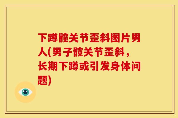 下蹲髋关节歪斜图片男人(男子髋关节歪斜，长期下蹲或引发身体问题)