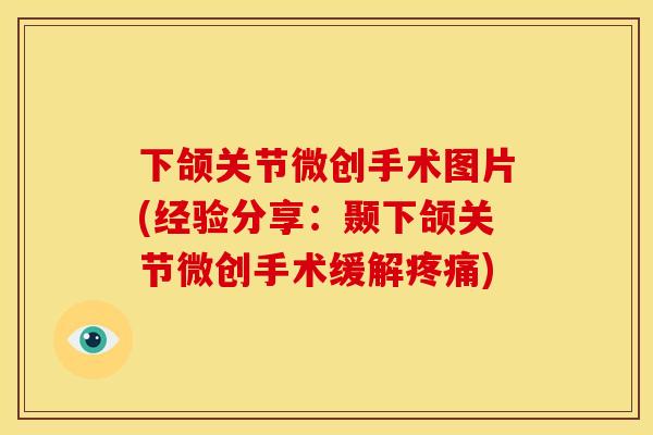 下颌关节微创手术图片(经验分享：颞下颌关节微创手术缓解疼痛)