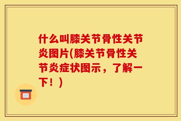 什么叫膝关节骨性关节炎图片(膝关节骨性关节炎症状图示，了解一下！)