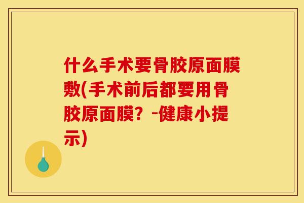 什么手术要骨胶原面膜敷(手术前后都要用骨胶原面膜？-健康小提示)