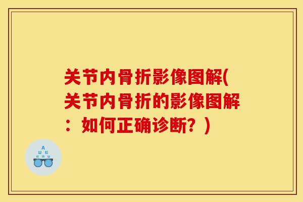 关节内骨折影像图解(关节内骨折的影像图解：如何正确诊断？)