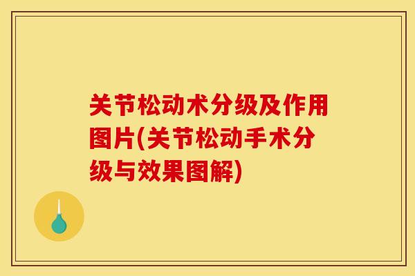 关节松动术分级及作用图片(关节松动手术分级与效果图解)