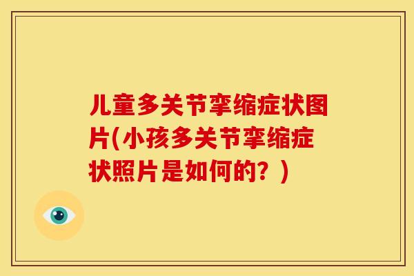 儿童多关节挛缩症状图片(小孩多关节挛缩症状照片是如何的？)