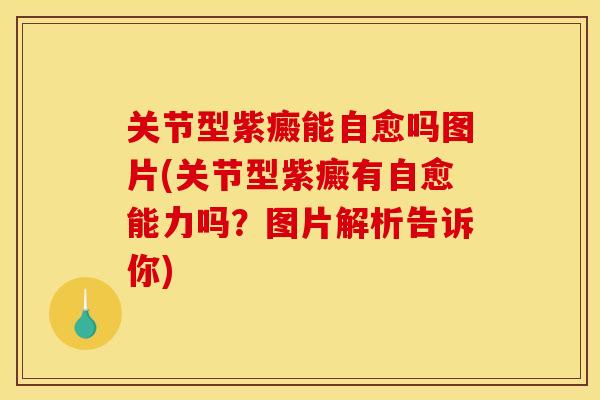 关节型紫癜能自愈吗图片(关节型紫癜有自愈能力吗？图片解析告诉你)