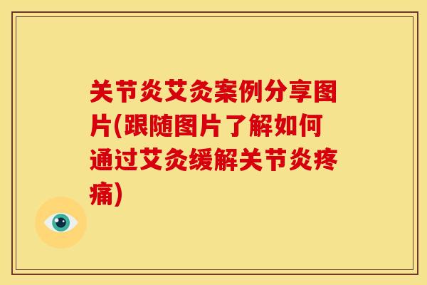 关节炎艾灸案例分享图片(跟随图片了解如何通过艾灸缓解关节炎疼痛)