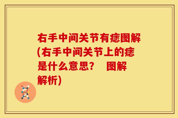 右手中间关节有痣图解(右手中间关节上的痣是什么意思？  图解解析)