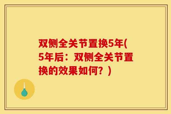 双侧全关节置换5年(5年后：双侧全关节置换的效果如何？)