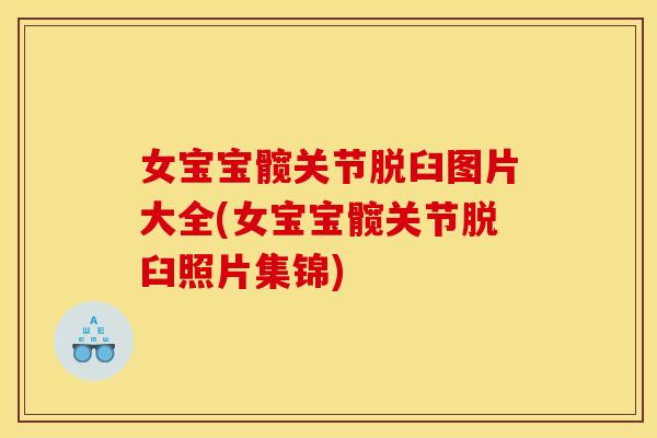 女宝宝髋关节脱臼图片大全(女宝宝髋关节脱臼照片集锦)