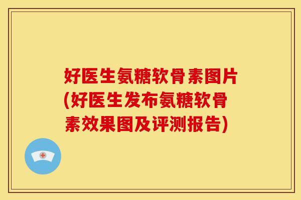 好医生氨糖软骨素图片(好医生发布氨糖软骨素效果图及评测报告)