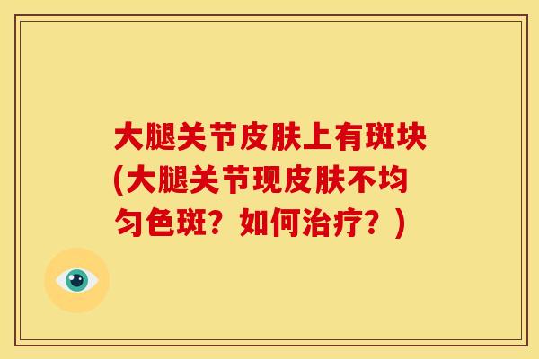 大腿关节皮肤上有斑块(大腿关节现皮肤不均匀色斑？如何治疗？)