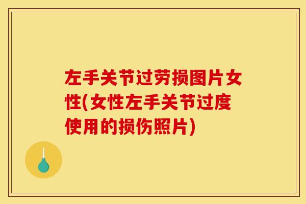 左手关节过劳损图片女性(女性左手关节过度使用的损伤照片)