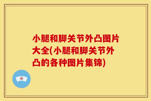 小腿和脚关节外凸图片大全(小腿和脚关节外凸的各种图片集锦)