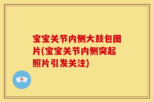 宝宝关节内侧大鼓包图片(宝宝关节内侧突起照片引发关注)