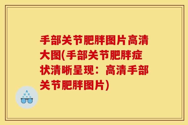 手部关节肥胖图片高清大图(手部关节肥胖症状清晰呈现：高清手部关节肥胖图片)