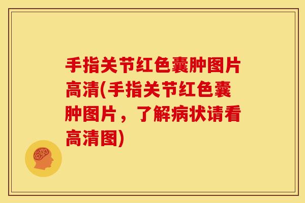 手指关节红色囊肿图片高清(手指关节红色囊肿图片，了解病状请看高清图)