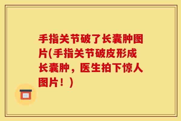 手指关节破了长囊肿图片(手指关节破皮形成长囊肿，医生拍下惊人图片！)