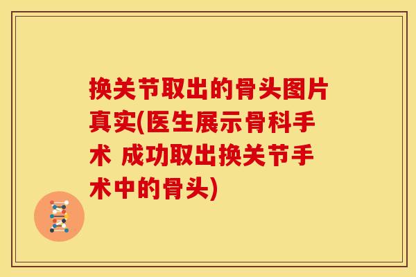 换关节取出的骨头图片真实(医生展示骨科手术 成功取出换关节手术中的骨头)