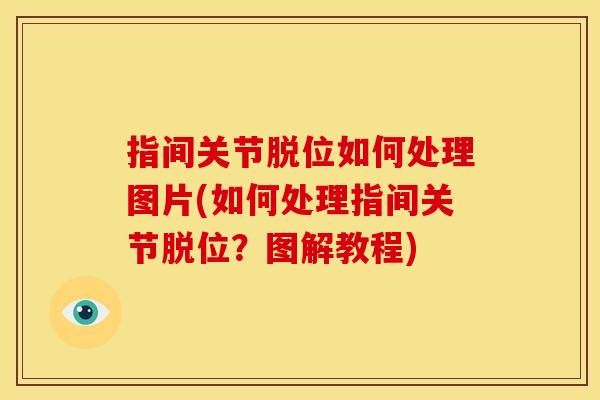 指间关节脱位如何处理图片(如何处理指间关节脱位？图解教程)