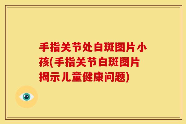 手指关节处白斑图片小孩(手指关节白斑图片揭示儿童健康问题)