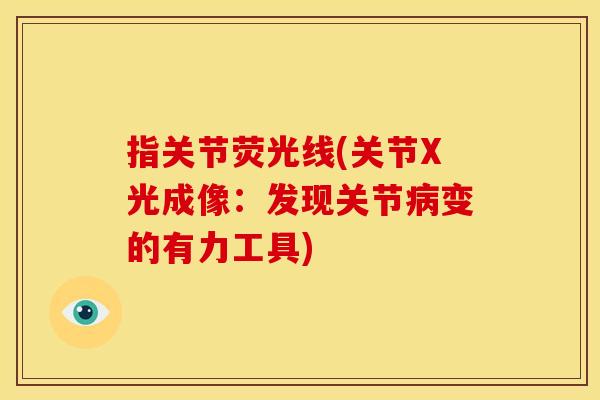 指关节荧光线(关节X光成像：发现关节病变的有力工具)