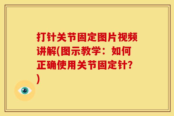 打针关节固定图片视频讲解(图示教学：如何正确使用关节固定针？)