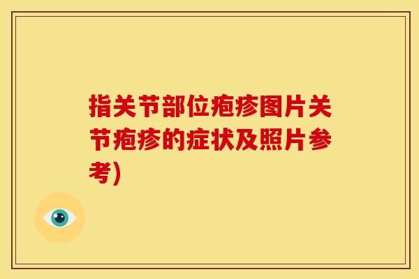 指关节部位疱疹图片关节疱疹的症状及照片参考)
