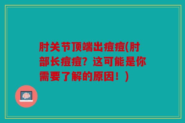 肘关节顶端出痘痘(肘部长痘痘？这可能是你需要了解的原因！)