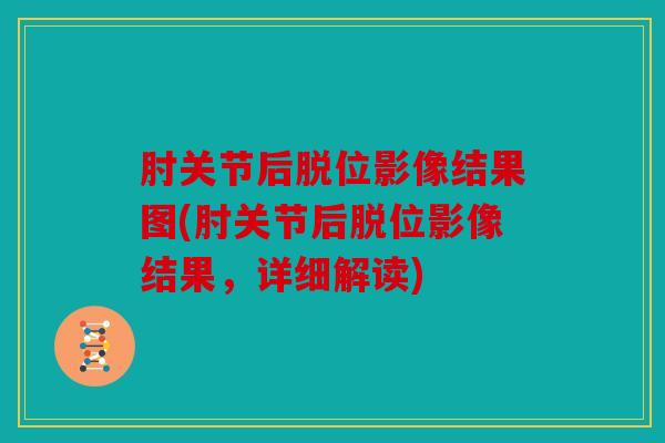 肘关节后脱位影像结果图(肘关节后脱位影像结果，详细解读)