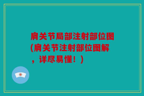 肩关节局部注射部位图(肩关节注射部位图解，详尽易懂！)