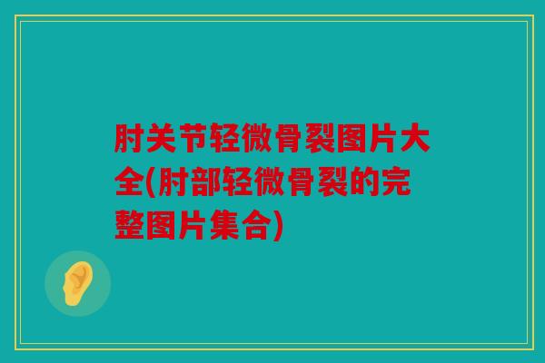 肘关节轻微骨裂图片大全(肘部轻微骨裂的完整图片集合)