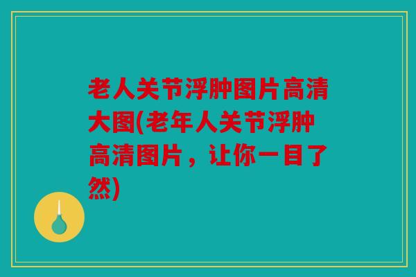 老人关节浮肿图片高清大图(老年人关节浮肿高清图片，让你一目了然)