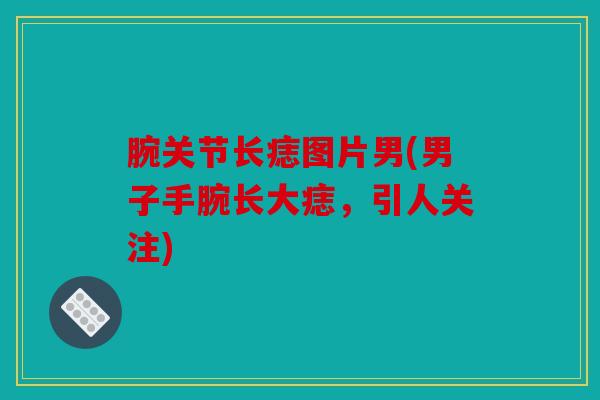 腕关节长痣图片男(男子手腕长大痣，引人关注)