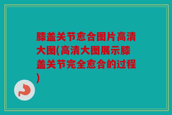 膝盖关节愈合图片高清大图(高清大图展示膝盖关节完全愈合的过程)