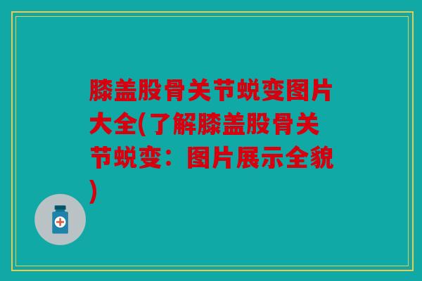 膝盖股骨关节蜕变图片大全(了解膝盖股骨关节蜕变：图片展示全貌)
